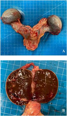 Case report: Findings in ovaries development from an aborted equine fetus
